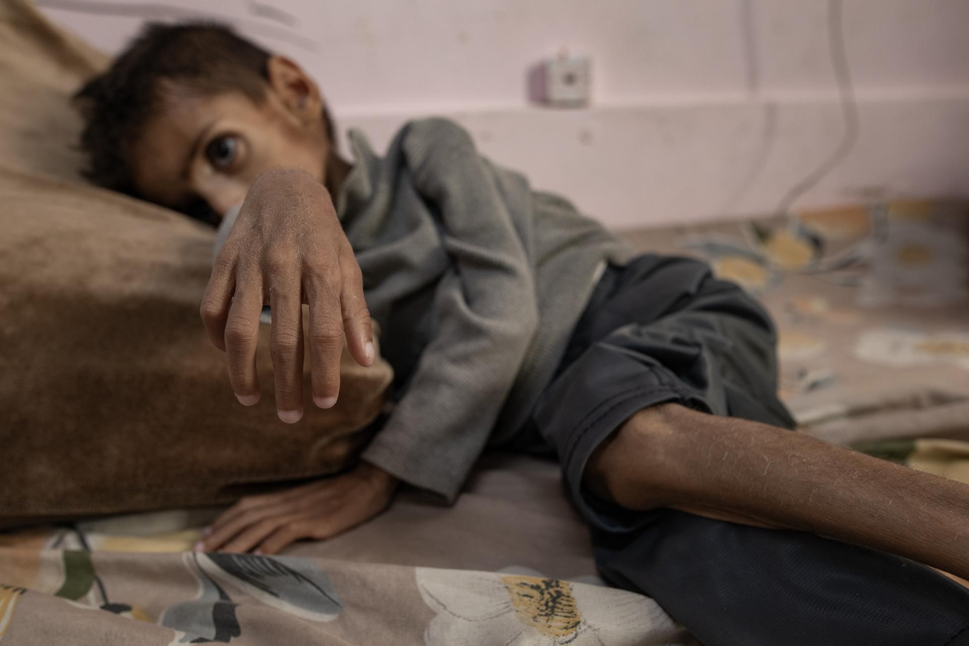 Alarmante aumento de desnutrición infantil en Gaza
